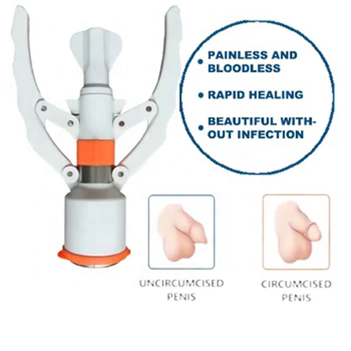 Surgical Circular Stapler Surgical Circular Stapler